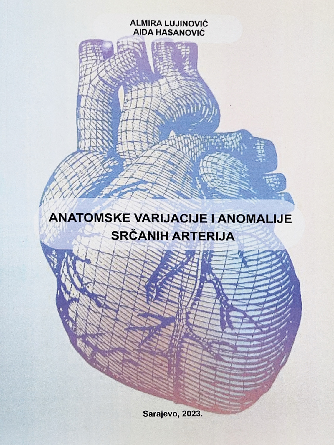 Anatomske varijacije i anomalije srčanih arterija